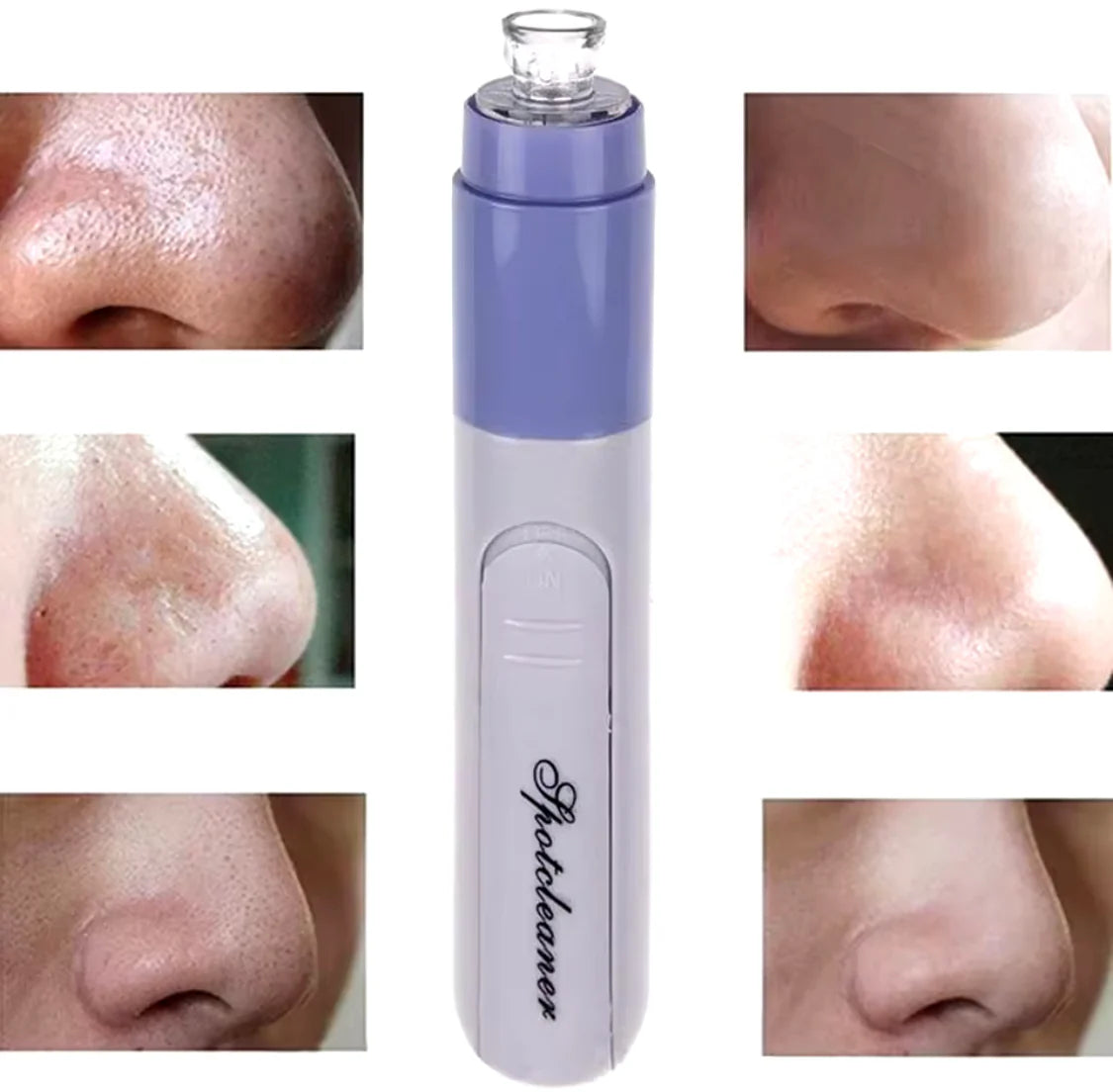 Electric Blackhead Remover & Pore Vacuum Cleaner