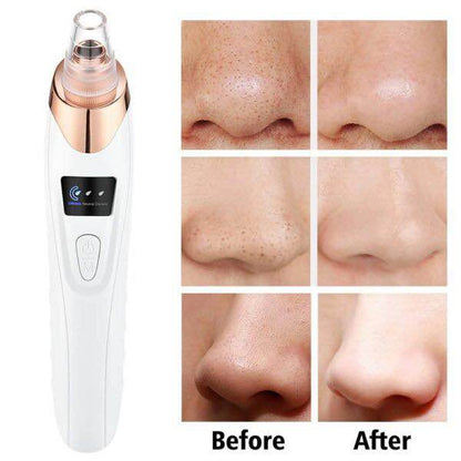 Electric Blackhead Remover & Pore Vacuum Cleaner